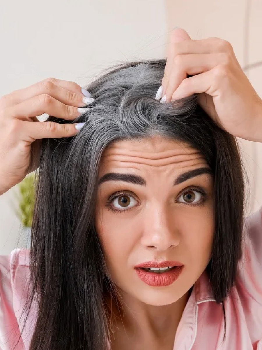 अकाली पांढऱ्या केसांची समस्या होईल दूर, फक्त वापरा 'या' २ वस्तू - Marathi News | अकाली पांढऱ्या केसांची समस्या होईल दूर, फक्त वापरा 'या' २ वस्तू | Latest Photos at Lokmat.com