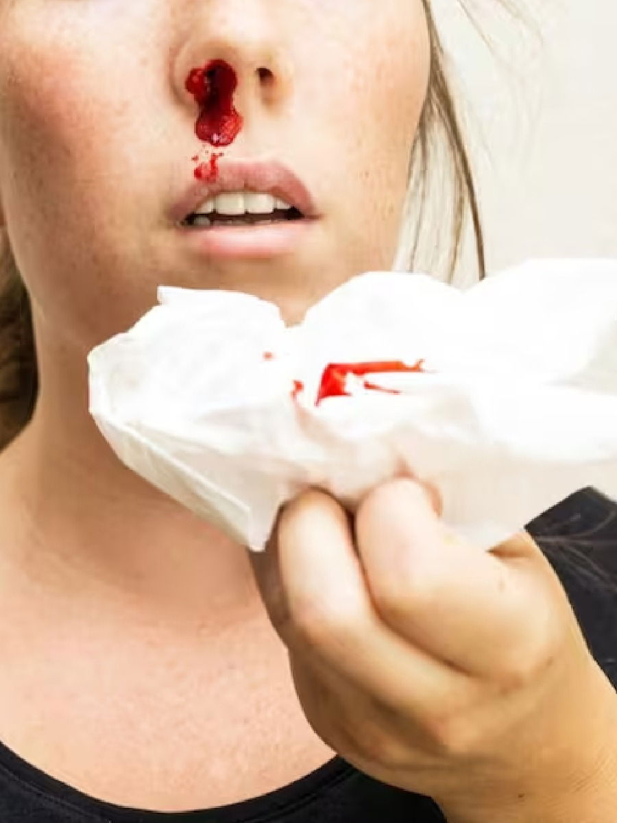 'या' शारीरिक तक्रारींकडे करु नका दुर्लक्ष, असू शकतो ब्लड कॅन्सर! - Marathi News | 'या' शारीरिक तक्रारींकडे करु नका दुर्लक्ष, असू शकतो ब्लड कॅन्सर! | Latest Photos at Lokmat.com