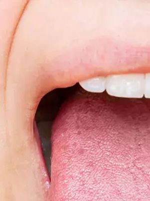 जिभेवरून समजते तुमच्या प्रकृतीची स्थिती? जाणून घ्या महत्वाची माहिती - Marathi News | जिभेवरून समजते तुमच्या प्रकृतीची स्थिती? जाणून घ्या महत्वाची माहिती | Latest Photos at Lokmat.com