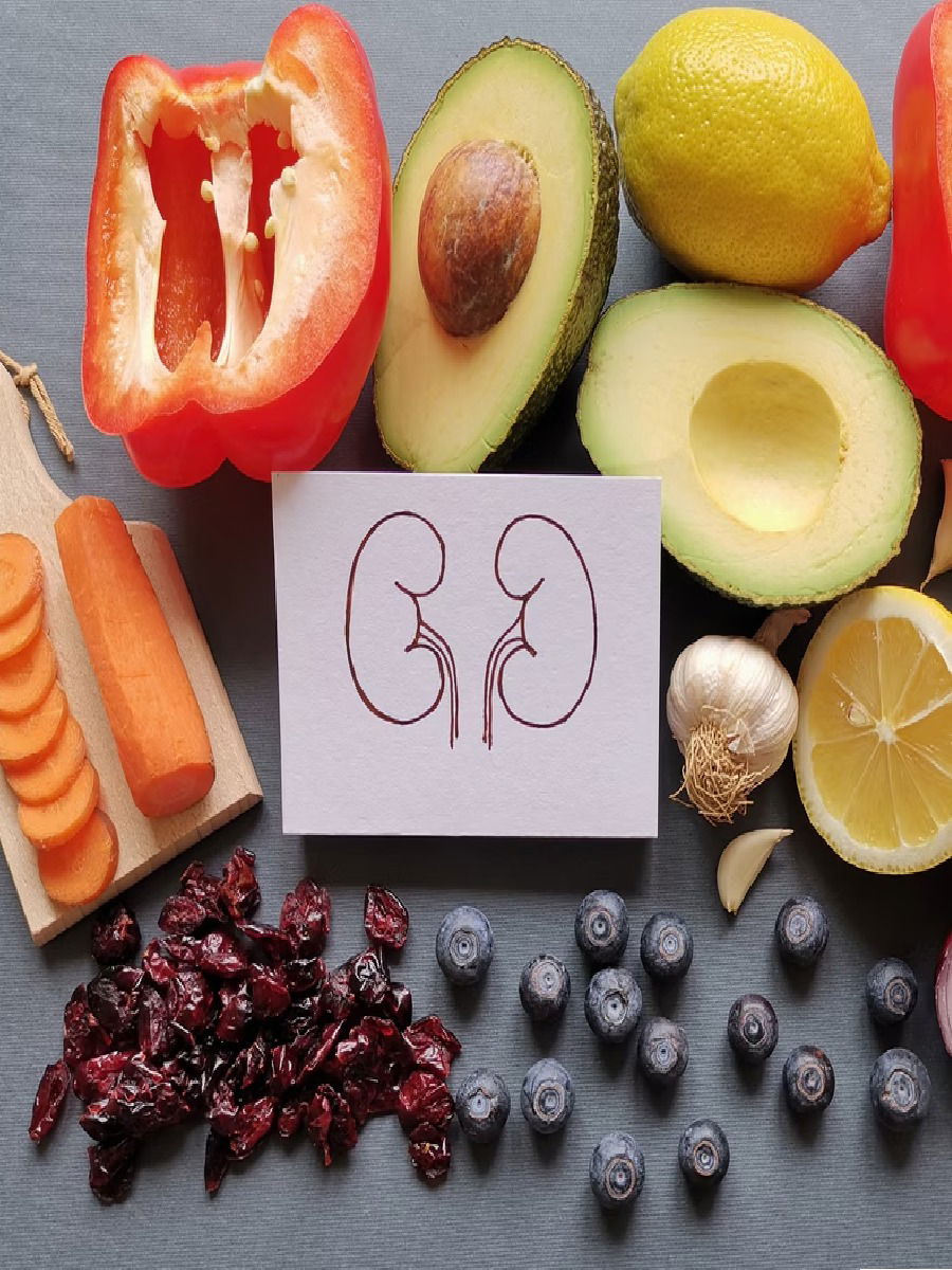 किडनी स्टोन असेल तर फॉलो करा 'हे' डाएट! - Marathi News | किडनी स्टोन असेल तर फॉलो करा 'हे' डाएट! | Latest Photos at Lokmat.com