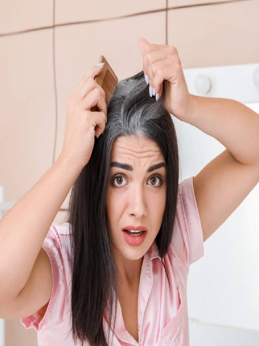 या व्हिटॅमिनच्या कमतरतेमुळे केस पांढरे होतात? - Marathi News | या व्हिटॅमिनच्या कमतरतेमुळे केस पांढरे होतात? | Latest Photos at Lokmat.com