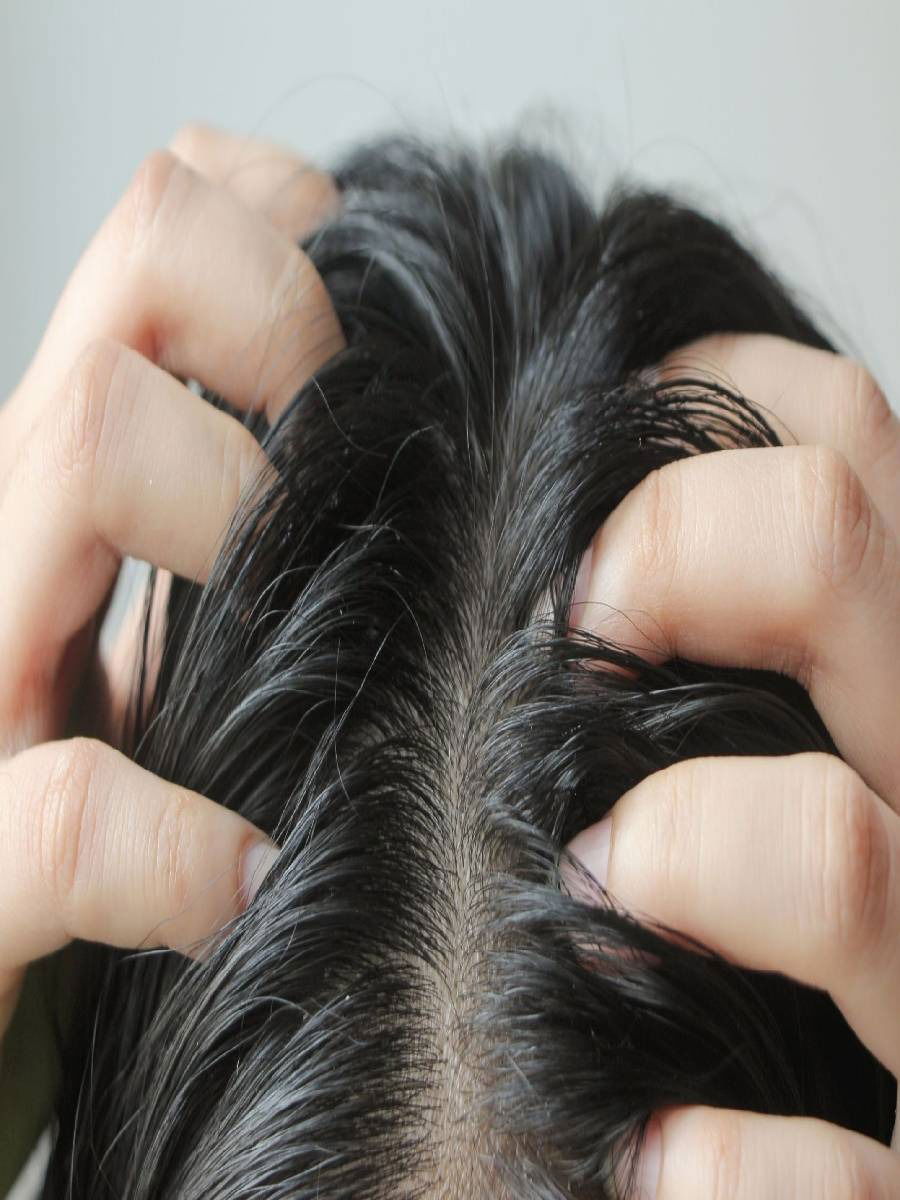 केसांमध्ये खाज होते? हा रामबाण उपाय करा - Marathi News | केसांमध्ये खाज होते? हा रामबाण उपाय करा | Latest Photos at Lokmat.com