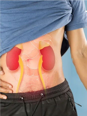 किडनी इन्फेक्शनची महत्त्वाची लक्षणे - Marathi News | किडनी इन्फेक्शनची महत्त्वाची लक्षणे | Latest Photos at Lokmat.com