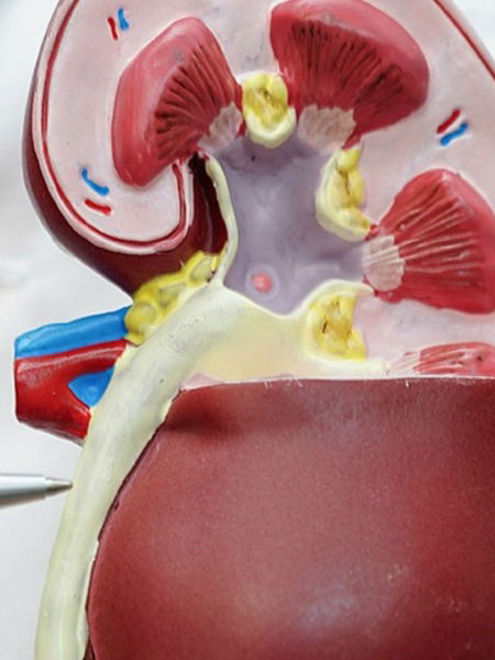 तुमच्या किडनीचं आरोग्य बिघडलंय हे सांगणारी ५ लक्षणं - Marathi News | तुमच्या किडनीचं आरोग्य बिघडलंय हे सांगणारी ५ लक्षणं | Latest Photos at Lokmat.com