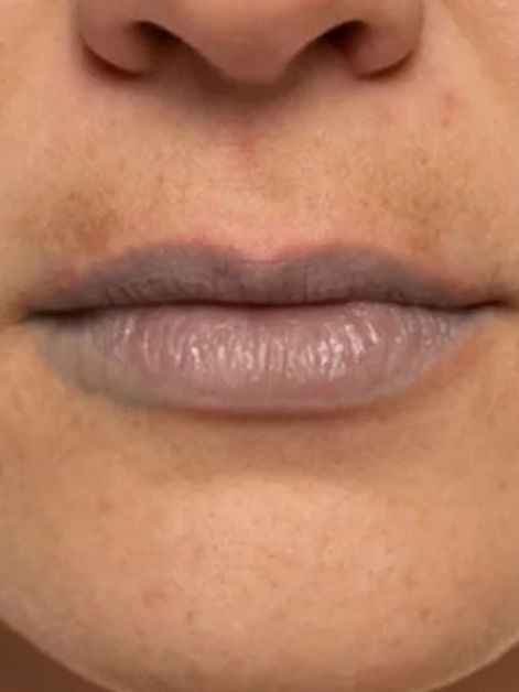 काळवंडलेल्या ओठांसाठी उपाय..! - Marathi News | काळवंडलेल्या ओठांसाठी उपाय..! | Latest Photos at Lokmat.com