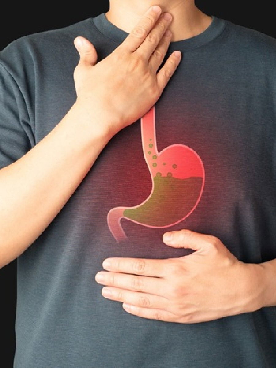 वारंवार होणारी अॅसिडिटी टाळण्यासाठी फॉलो करा 'हे' रुल्स - Marathi News | वारंवार होणारी अॅसिडिटी टाळण्यासाठी फॉलो करा 'हे' रुल्स | Latest Photos at Lokmat.com