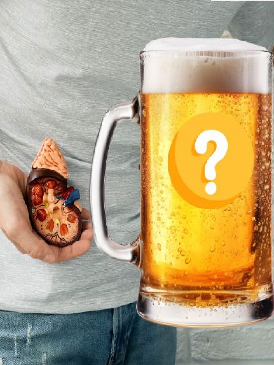 बिअर प्यायल्यामुळे खरंच किडनी स्टोन बरा होतो? - Marathi News | बिअर प्यायल्यामुळे खरंच किडनी स्टोन बरा होतो? | Latest Photos at Lokmat.com