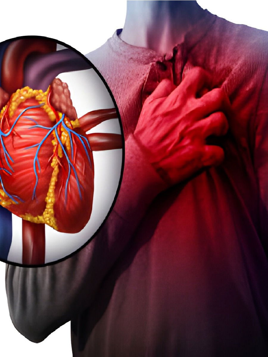 जपा हृदयाचं आरोग्य, ही लक्षण दर्शवतात नसांमधील ब्लॉकेज! - Marathi News | जपा हृदयाचं आरोग्य, ही लक्षण दर्शवतात नसांमधील ब्लॉकेज! | Latest Photos at Lokmat.com