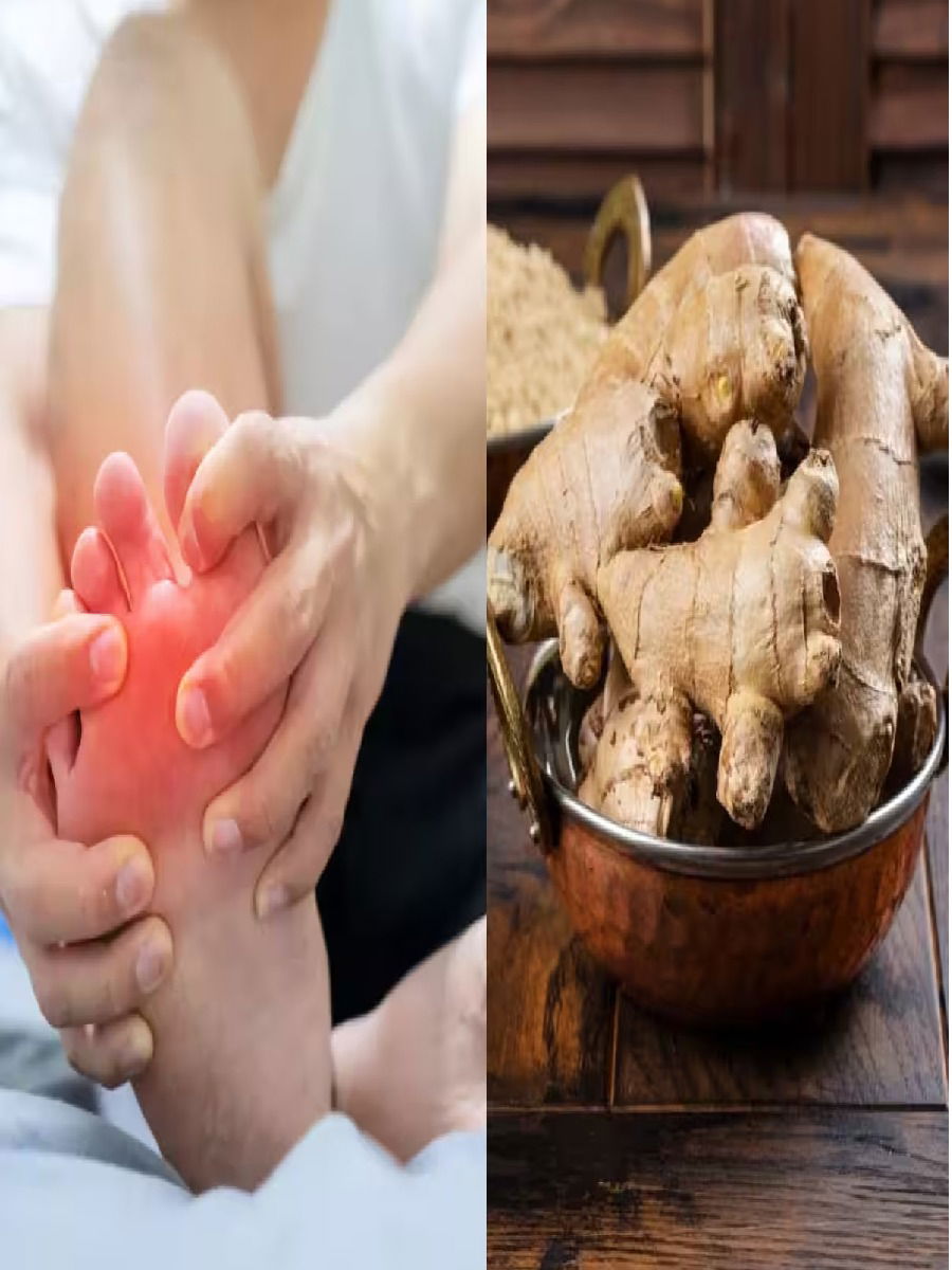 शरीरातील Uric Acid वाढलंय? काळजी करु नका, आलं वापरुन करा कंट्रोल - Marathi News | शरीरातील Uric Acid वाढलंय? काळजी करु नका, आलं वापरुन करा कंट्रोल | Latest Photos at Lokmat.com