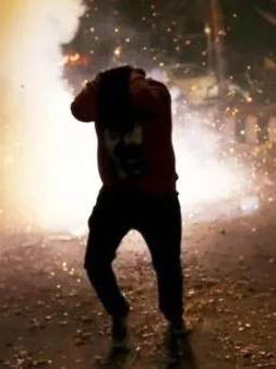 फुफ्फुसांचे आजार; कर्करोगाचा धोका, फटाक्यांचे शरीरावर गंभीर दुष्परिणाम - Marathi News | फुफ्फुसांचे आजार; कर्करोगाचा धोका, फटाक्यांचे शरीरावर गंभीर दुष्परिणाम | Latest Photos at Lokmat.com