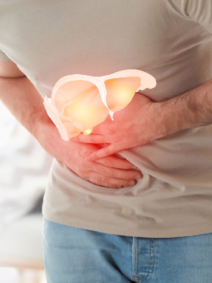 या गोष्टींकडे करु नका दुर्लक्ष, असू शकते फॅटी लिव्हरची समस्या - Marathi News | या गोष्टींकडे करु नका दुर्लक्ष, असू शकते फॅटी लिव्हरची समस्या | Latest Photos at Lokmat.com