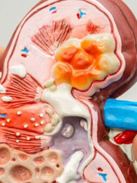 हळूहळू किडनी खराब करणाऱ्या ३ वाईट सवयी - Marathi News | हळूहळू किडनी खराब करणाऱ्या ३ वाईट सवयी | Latest Photos at Lokmat.com