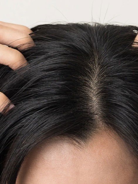 टाळूला खाज सुटते? ५ उपायांनी मिळवा आराम - Marathi News | टाळूला खाज सुटते? ५ उपायांनी मिळवा आराम | Latest Photos at Lokmat.com टाळूला खाज सुटते? ५ उपायांनी मिळवा आराम - Marathi News | टाळूला खाज सुटते? ५ उपायांनी मिळवा आराम | Latest Photos at Lokmat.com