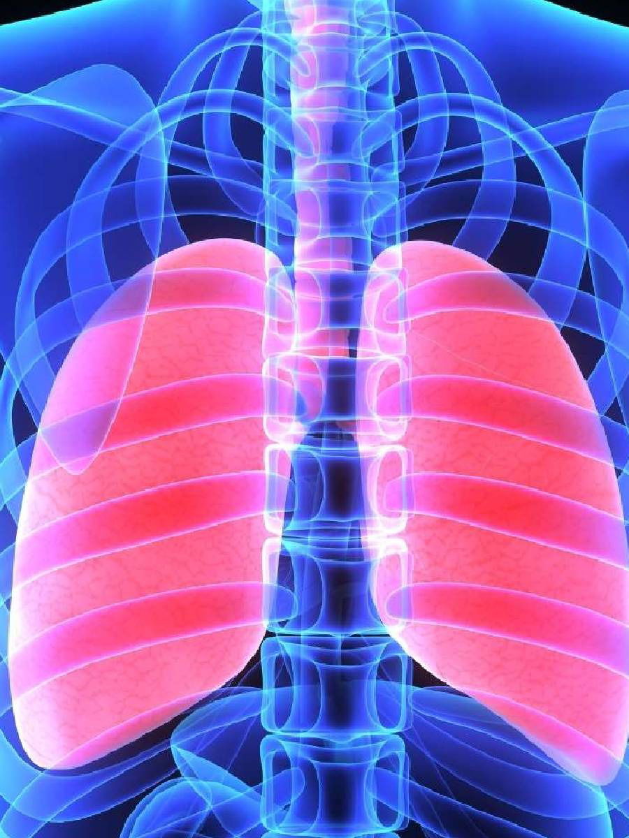 सकाळी ही लक्षण दिसली तर दुर्लक्ष करू नका; फुफ्फुसांचे आजार होऊ शकतात - Marathi News | सकाळी ही लक्षण दिसली तर दुर्लक्ष करू नका; फुफ्फुसांचे आजार होऊ शकतात | Latest Photos at Lokmat.com